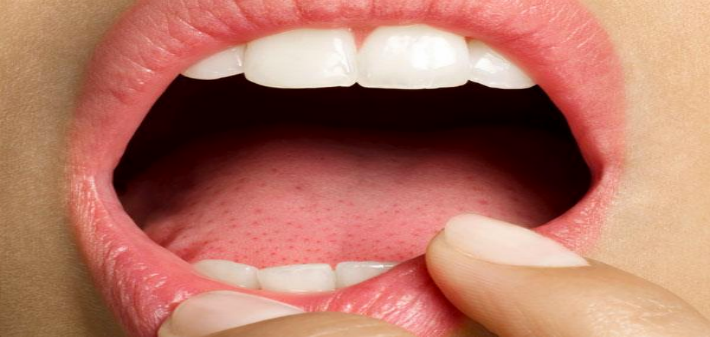 oral warning signs of possible disease