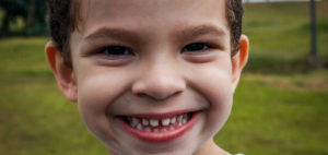 A young boy smiles widely at the camera, showing all his teeth.