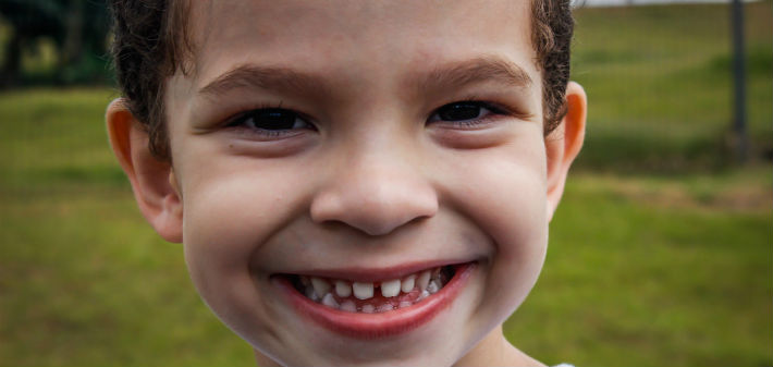 A young boy smiles widely at the camera, showing all his teeth.