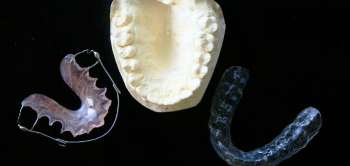 A plaster cast of upper teeth sits between a clear retainer and a clear, molded mouth guard.