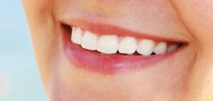 A pretty smile with teeth that are stronger and healthier after a flouride treatment.