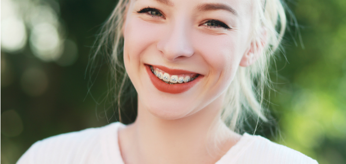 tips for living with braces, orthodontics, little rock