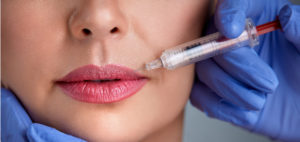 A dentist is injecting Botox into a woman's lips.