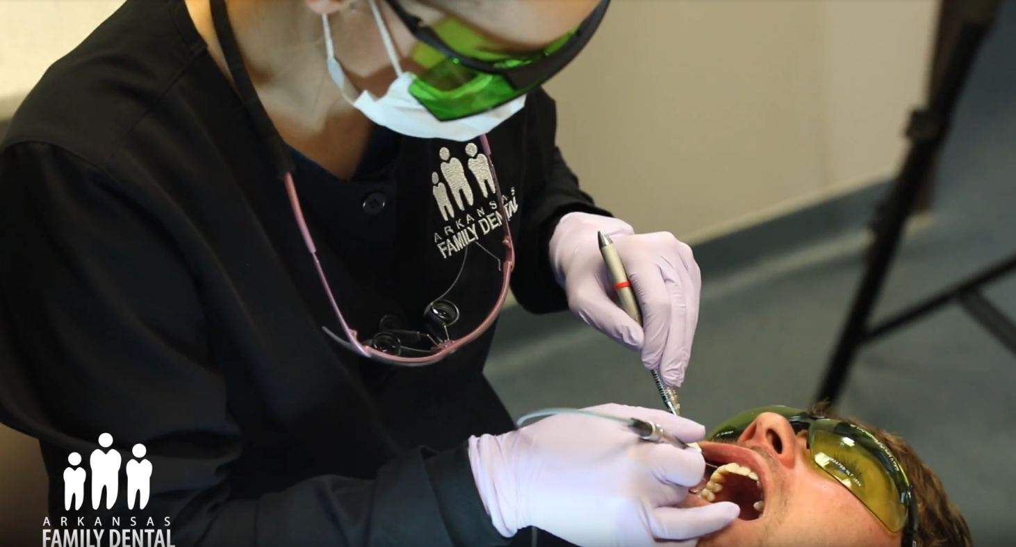 A female Arkansas Family Dental technician cleans a male patients teeth.