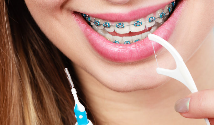 Tips to make it easier flossing with braces.