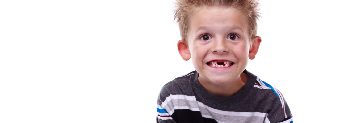 A Little Rock, AR boy gives a silly grin, showing his missing front teeth amidst other teeth that have seen good dental care.