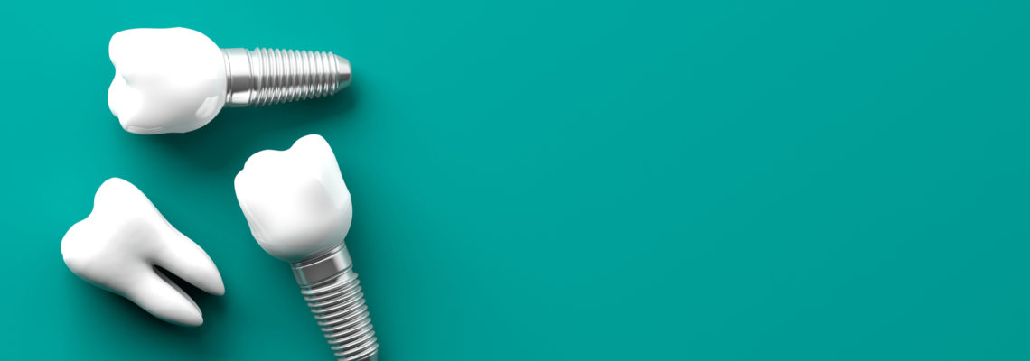 A tooth and two dental implants are isolated on a teal background.
