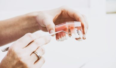 A dentist's hands point to a dental implant fixture on a set of model teeth.