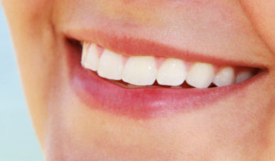 A pretty smile with teeth that are stronger and healthier after a flouride treatment.