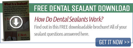 dental-sealants