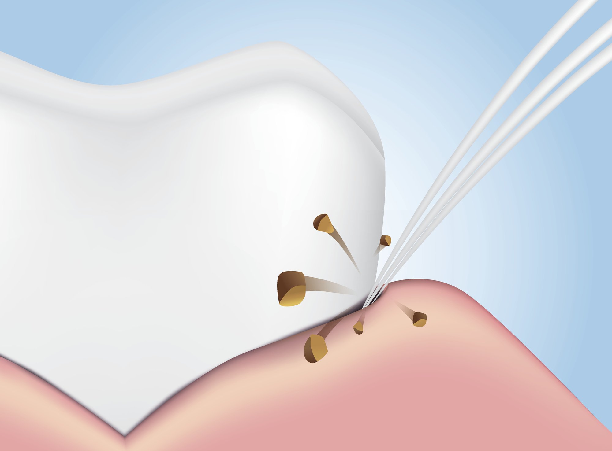 The Best Way To Remove Plaque From Your Teeth