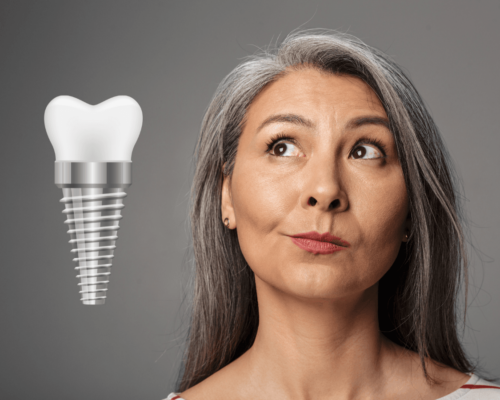 Dental Implants vs. Dental Bridges cover