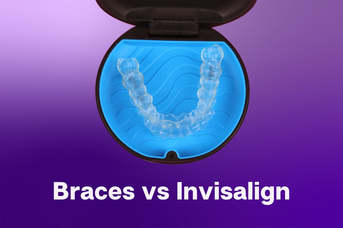 Invisalign vs Braces: Which One Is Right for You cover