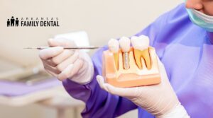 cosmetic dental implants