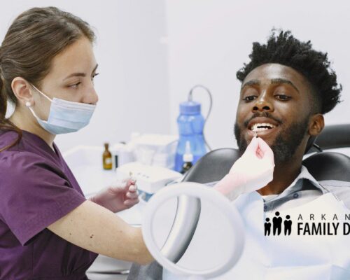 professional teeth whitening
